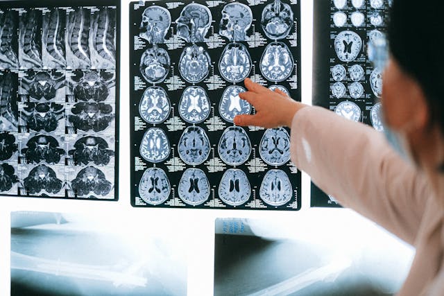 How Long Does Your Brain Take to Recover from Drugs? Understanding the Healing Process